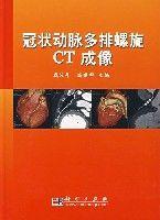 冠狀動脈多排螺旋CT成像