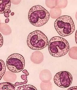 白細胞疾病 白細胞疾病