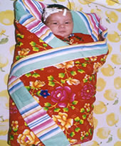 羊水與胎糞吸入綜合症