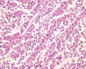 免疫組化 免疫組化