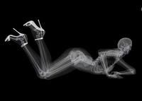 人體X光圖片