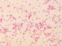 副溶血孤菌腸炎 副溶血孤菌腸炎