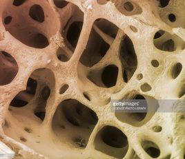 骨祖細胞