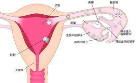 青春期多囊卵巢綜合徵 青春期多囊卵巢綜合徵