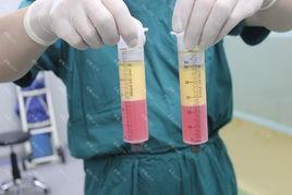 脂肪分級分離 脂肪分級分離