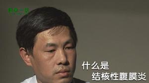 結核性腹膜炎 結核性腹膜炎