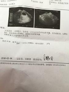 心管搏動 心管搏動