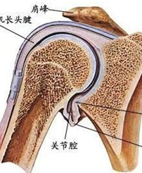 退變性關節病 退變性關節病