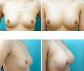 維妮美三維雙C動感豐胸 維妮美三維雙C動感豐胸