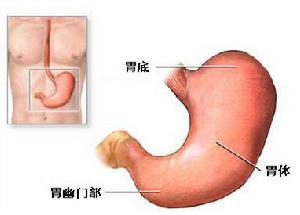 急性腸胃炎