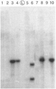 雜交的顯影結果