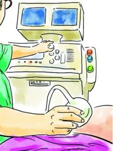 肝臟局灶性結節性增生 肝臟局灶性結節性增生