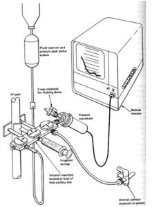 中心靜脈壓測定