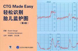 輕鬆識別胎兒監護圖 輕鬆識別胎兒監護圖