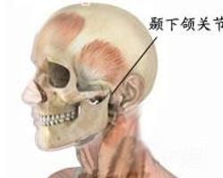 顳頜關節脫位 顳頜關節脫位