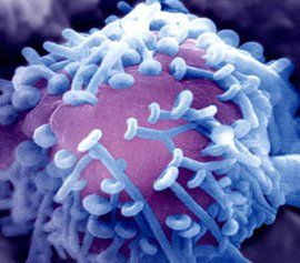 慢性炎性脫髓鞘性多發性神經病