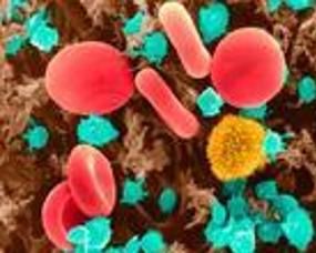 鏈球菌感染 鏈球菌感染