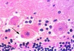 內基小體 內基小體