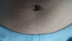 白斑凹唇姜 白斑凹唇姜