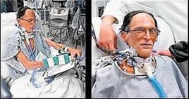 無心人[人工心臟植入者]