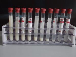 肺泡蛋白沉著症