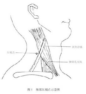 肩胛背神經卡壓症