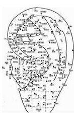 耳針療法 耳針療法