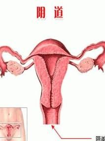 陰道清潔度檢查 陰道清潔度檢查