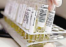 家族性地中海熱