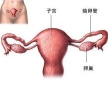 宮頸粘連 宮頸粘連