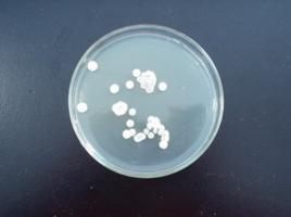 白色鏈黴菌 白色鏈黴菌