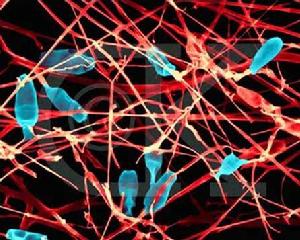 血小板功能異常