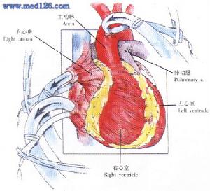 冠狀動脈異位起源