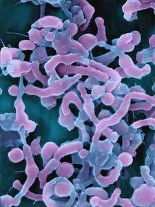 幽門螺桿菌 幽門螺桿菌