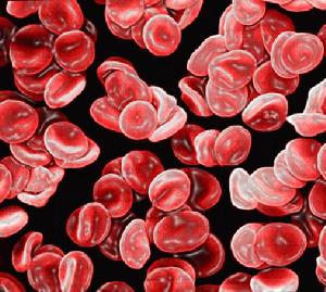 先天性純紅細胞再生障礙性貧血