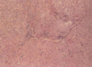 豬黃麴黴毒素中毒