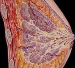 雙離子乳腺速溶療法 雙離子乳腺速溶療法