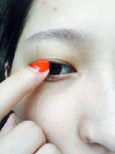 雙眼皮線 雙眼皮線