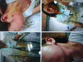 南京護士被打事件 南京護士被打事件