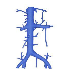 下腔靜脈 下腔靜脈