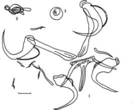 錨首蟲科 錨首蟲科