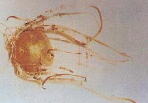 馬鈴薯立枯絲核菌病