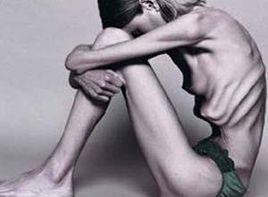 情緒性厭食 情緒性厭食