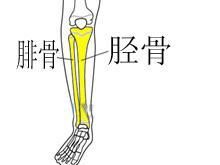 脛腓骨幹骨折 脛腓骨幹骨折