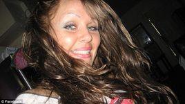 米斯蒂·阿特金森 米斯蒂·阿特金森