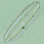 尖布紋藻 尖布紋藻