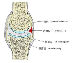 關節滑膜襞 關節滑膜襞