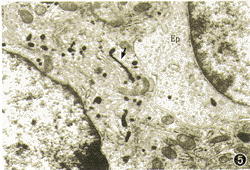 分散高爾基體 分散高爾基體