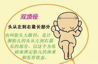 胎頭雙頂徑 胎頭雙頂徑