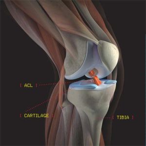 關節積液 關節積液
